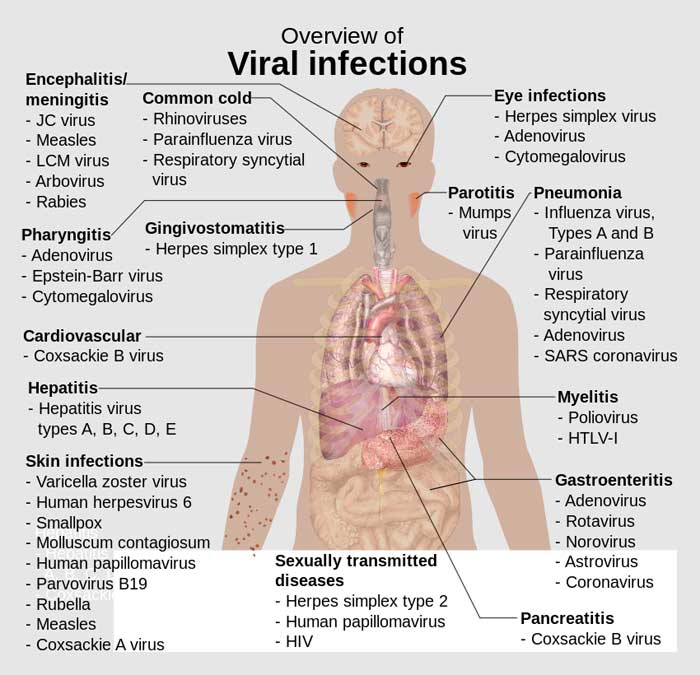 Overview of viral infections - chart