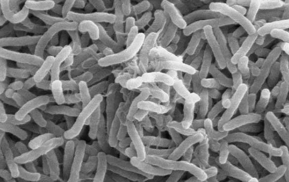 Cholera bacteria