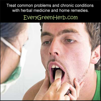 Common health problems can be treated with herbal medicine.