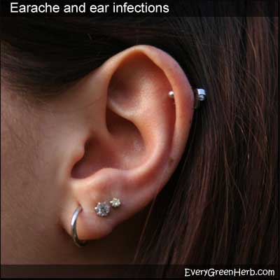 Ear piercings should be cleaned with alcohol regularly.